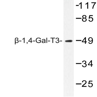 (beta)-1,4-Gal-T3 (F304) pAb