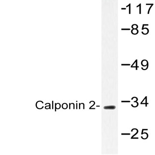 Calponin 2 (D156) pAb