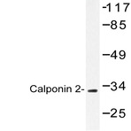 Calponin 2 (D156) pAb