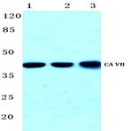 CA VB (N280) pAb