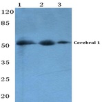 Cerebral 1 (L310) pAb