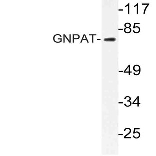 GNPAT (F365) pAb