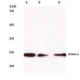 DNAL1 (N161) pAb