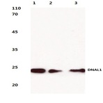 DNAL1 (N161) pAb