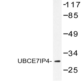 UBCE7IP4 (R184) pAb