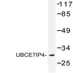 UBCE7IP4 (R184) pAb