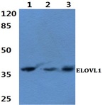 ELOVL1 (F139) pAb