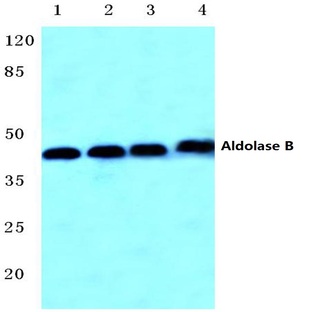 Aldolase B (W148) pAb