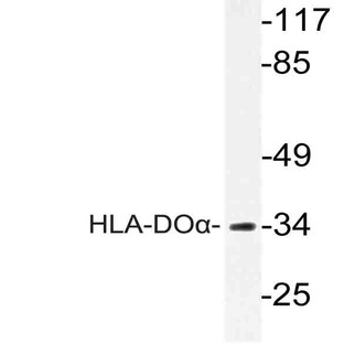 HLA-DO(alpha) (V111) pAb