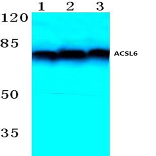 ACSL6 (D531) pAb