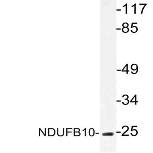 NDUFB10 (E95) pAb