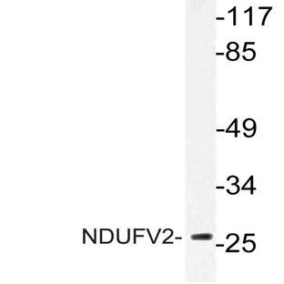 NDUFV2 (P52) pAb