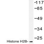 Histone H2B (P8) pAb