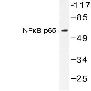 NFkB-p65 (K303) pAb