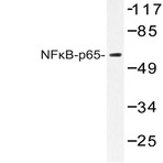 NFkB-p65 (K303) pAb