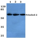 Frizzled-2 (E240) pAb