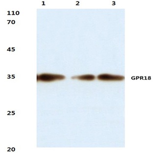 GPR18 (C172) pAb