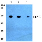 ETAR (D424) pAb