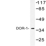 DOR-1 (F345) pAb