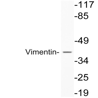 Vimentin (S55) pAb