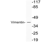 Vimentin (S55) pAb