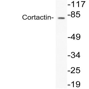 Cortactin (T440) pAb