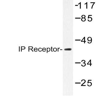 IP Receptor (H237) pAb