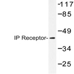 IP Receptor (H237) pAb