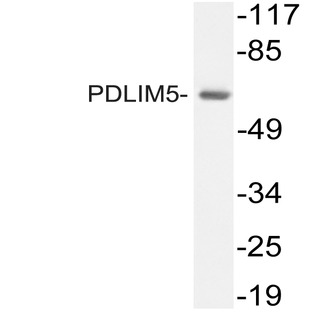 PDLIM5 (S257) pAb