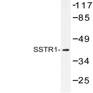 SSTR1 (N48) pAb