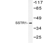 SSTR1 (N48) pAb