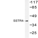 SSTR4 (Q194) pAb