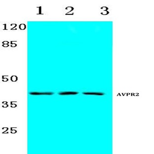 AVP Receptor V2 (L111) pAb