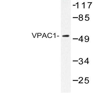 VPAC1 (V371) pAb