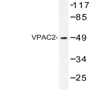 VPAC2 (F122) pAb