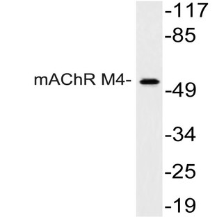 mAChR M4 (P277) pAb