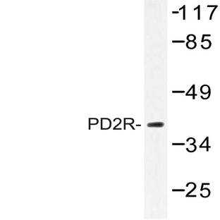 PD2R (E301) pAb