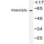 PAK4/5/6 (V469) pAb