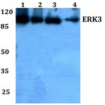 ERK3 (K185) pAb