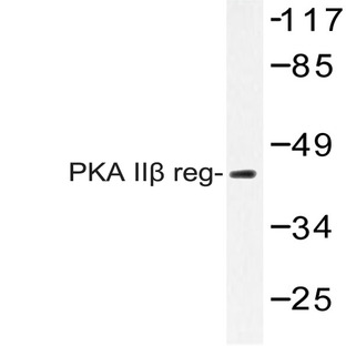 PKA II(beta) reg (T109) pAb