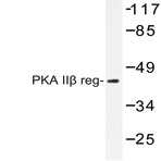 PKA II(beta) reg (T109) pAb