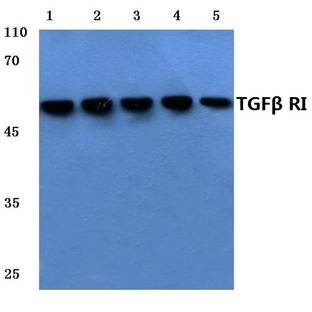 TGF(beta) RI (E161) pAb