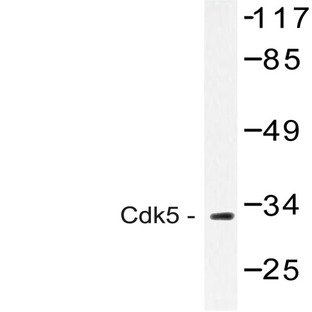 CDK5 (G11) pAb