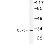 CDK5 (G11) pAb