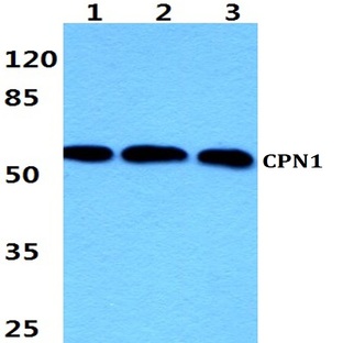 CPN1 (Q452) pAb