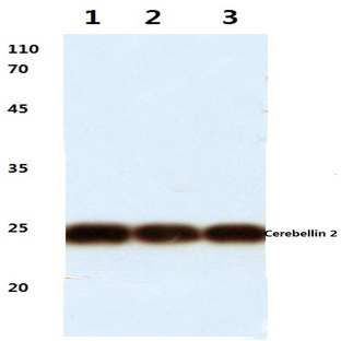 Cerebellin 2 (L202) pAb