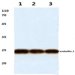 Cerebellin 2 (L202) pAb