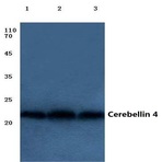 Cerebellin 4 (K178) pAb