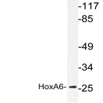 Hox-A6 (P135) pAb