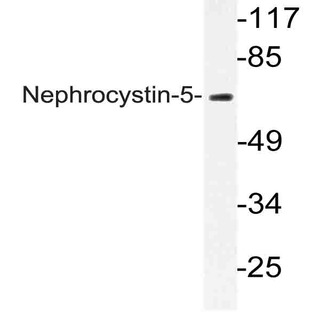 Nephrocystin-5 (R467) pAb